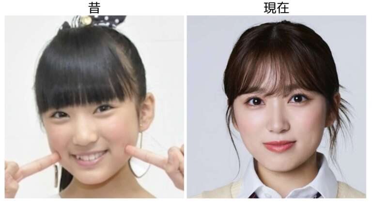 矢吹奈子 整形
