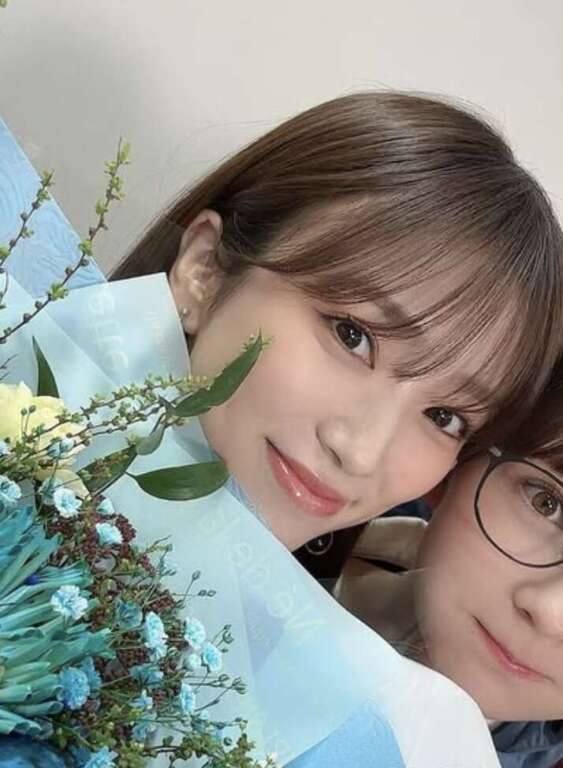 矢吹奈子 整形