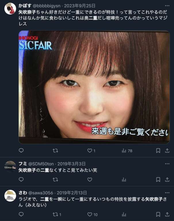 矢吹奈子 整形