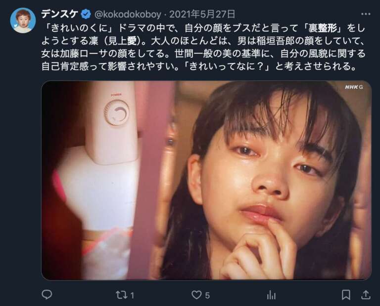 見上愛 整形