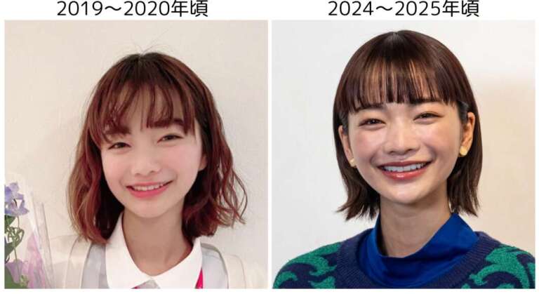 見上愛 整形