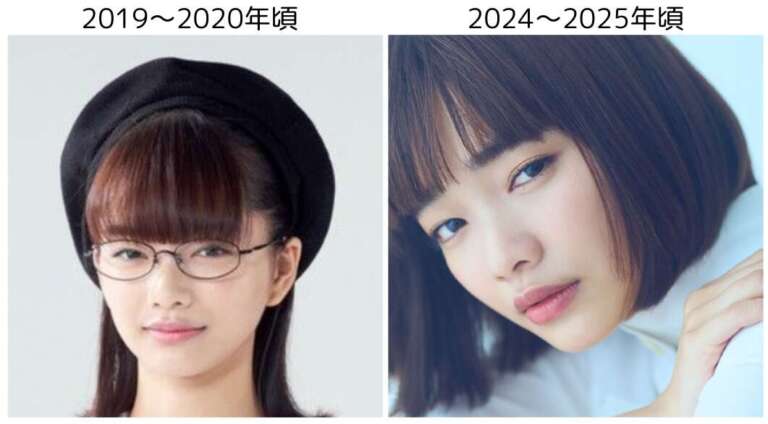 見上愛 整形