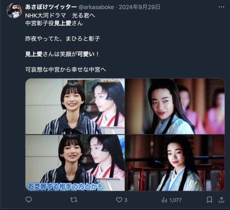 見上愛 整形