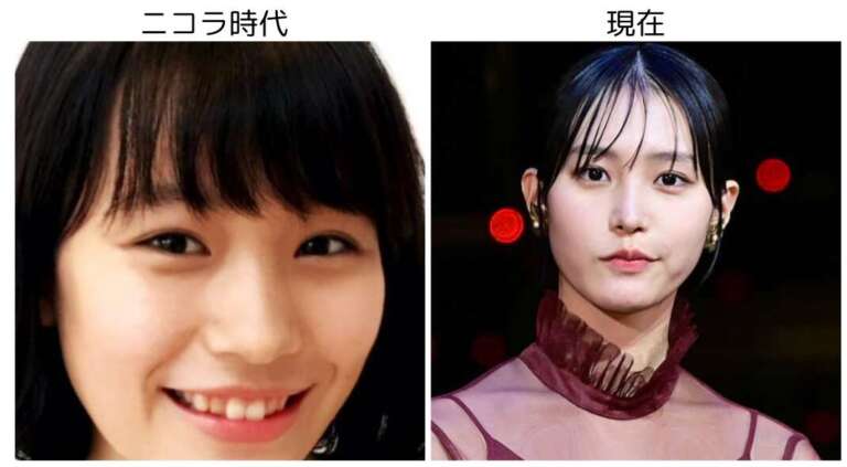 南沙良 顔変わった