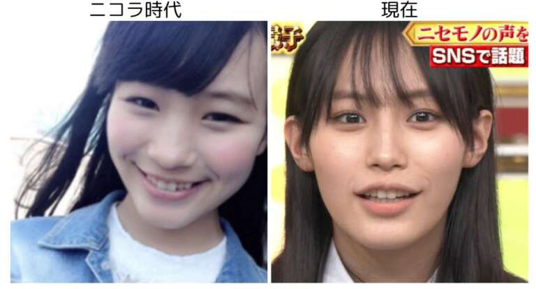 南沙良 顔変わった