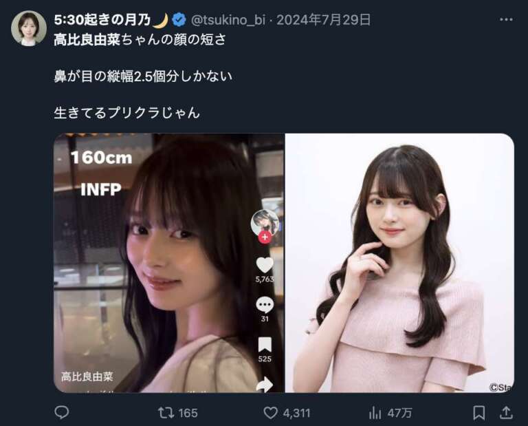 高比良由菜 整形