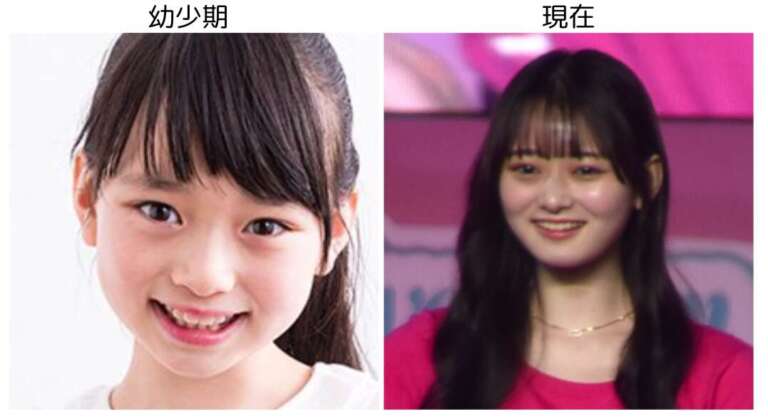 高比良由菜 整形