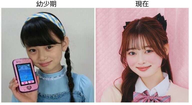 高比良由菜 整形