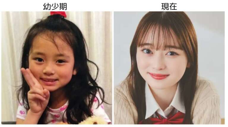 高比良由菜 整形