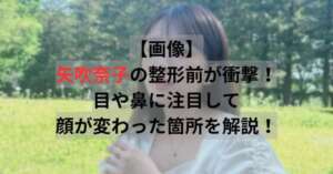 矢吹奈子　整形
