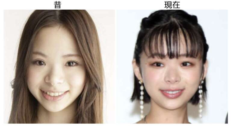 趣里の昔と現在の比較画像１３