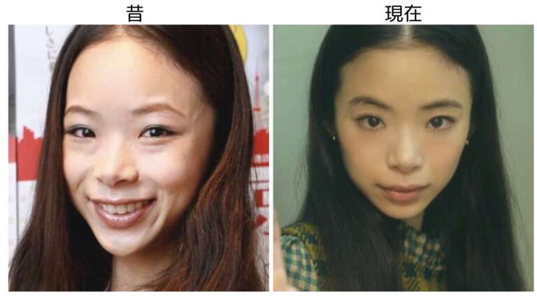趣里の昔と現在の比較画像２