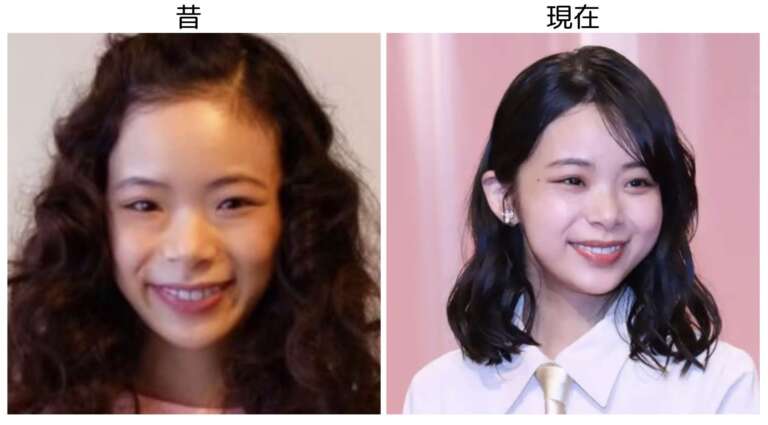 趣里の昔と現在の比較画像１
