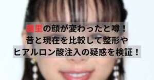 趣里の顔が変わったと噂！昔と現在を比較して整形やヒアルロン酸の注入の疑惑を検証！